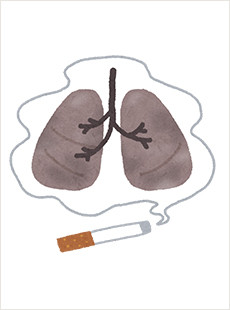 肺がん（はいがん）